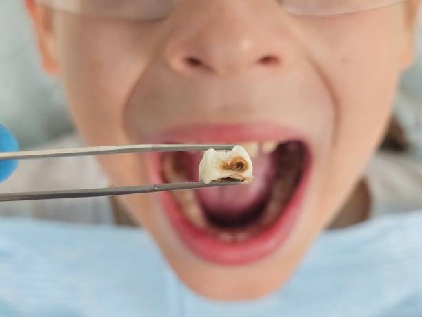 Best Emergency Treatment for Jaw Pain or Injury in Kinnelon, NJ