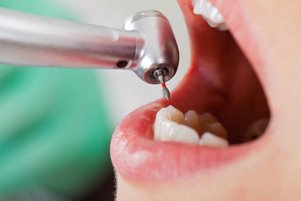 Best Emergency Care for Gum Disease in Kinnelon, NJ